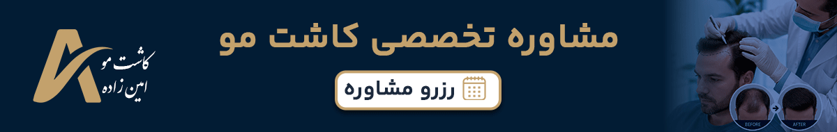 مشاوره تخصصی کاشت مو - رزرو مشاوره کلینیک امین زاده